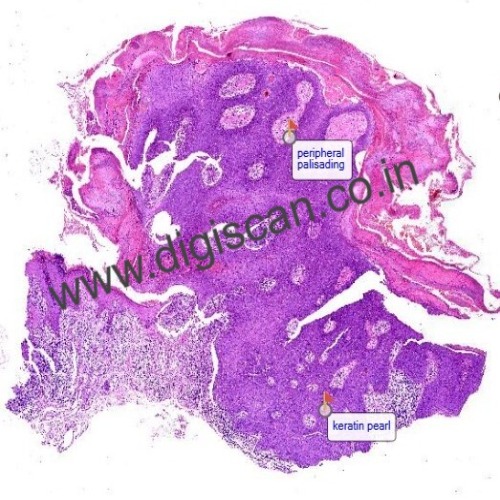 Oral Pathology Digital Slides Set (MDS & PG Students)